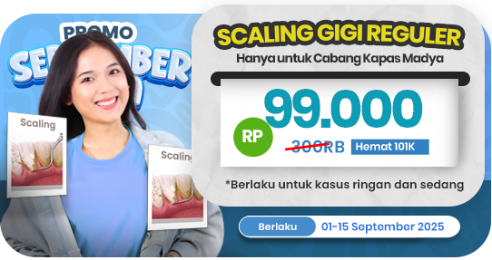 Scaling Gigi Reguler (khusus opening Kapas Madya)